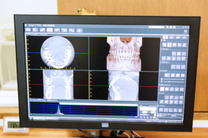 歯科用X線CTの各医療機関様へのご案内　福山市　わだ歯科クリニック